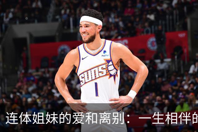 连体姐妹的爱和离别：一生相伴的传奇故事